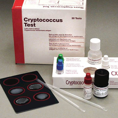 Bacterial latex antigen tests