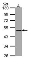 SERPINA7 Polyclonal Antibody, Invitrogen&trade; 100 &mu;L; Unconjugated 