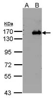 BRPF1 Polyclonal Antibody, Invitrogen&trade; 100 &mu;L; Unconjugated 