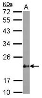 CRP2 Polyclonal Antibody, Invitrogen&trade; 100 &mu;L; Unconjugated 