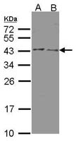 HSD3B2 Polyclonal Antibody, Invitrogen&trade; 100 &mu;L; Unconjugated 