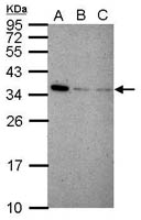 IFI35 Polyclonal Antibody, Invitrogen&trade; 100 &mu;L; Unconjugated 