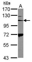 CD41 Polyclonal Antibody, Invitrogen&trade; 100 &mu;L; Unconjugated 