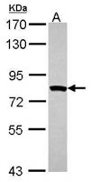 MTMR2 Polyclonal Antibody, Invitrogen&trade; 100 &mu;L; Unconjugated 