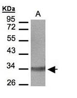 LTB4R Polyclonal Antibody, Invitrogen&trade; 100 &mu;L; Unconjugated 