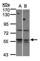 MST3 Polyclonal Antibody, Invitrogen&trade; 100 &mu;L; Unconjugated 