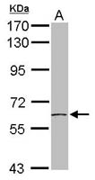 TCP-1 eta Polyclonal Antibody, Invitrogen&trade; 100 &mu;L; Unconjugated 