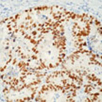 Epredia&trade;&nbsp;Lab Vision&trade; p53 Ab-1 Mouse Monoclonal Antibody, 200&mu;g/mL, BSA and azide 1mL; 200&mu;g/mL; Unlabeled; Purified with BSA and azide 