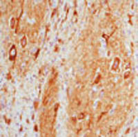 MAP 2a,b,c (Microtubule-Associated Protein) Ab-3 Mouse Monoclonal Antibody, Epredia&trade; 1mL; 200&mu;g/mL; Unlabeled; Purified with BSA and azide 