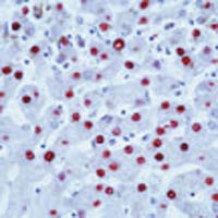 500 UL HEPATITIS B VIRUS CORE ANTIGEN (HBVCAG)Ab-1 Rabbit pAb (Purified Ab with BSA and Azide)  