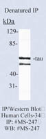 Tau Ab-2 Mouse Monoclonal Antibody, Epredia&trade; 100&mu;L; 1mg/mL; Unlabeled; Purified without BSA and azide 